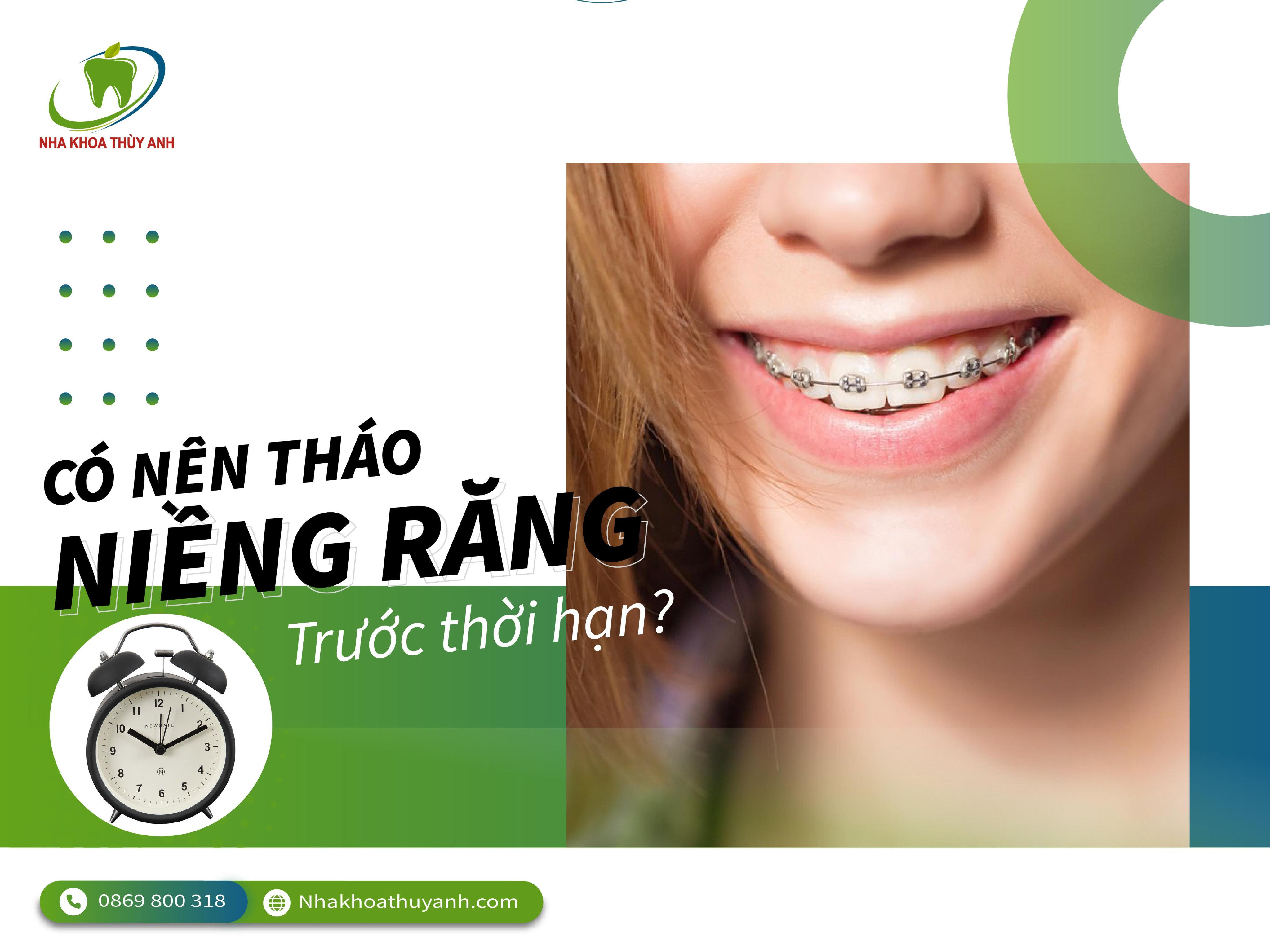 Có nên tháo niềng răng trước thời hạn – niềng răng Thái Nguyên?