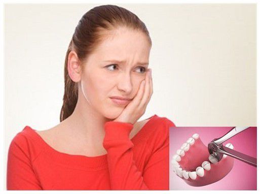 Sau khi nhổ răng khôn bị sưng mặt phải làm sao? 