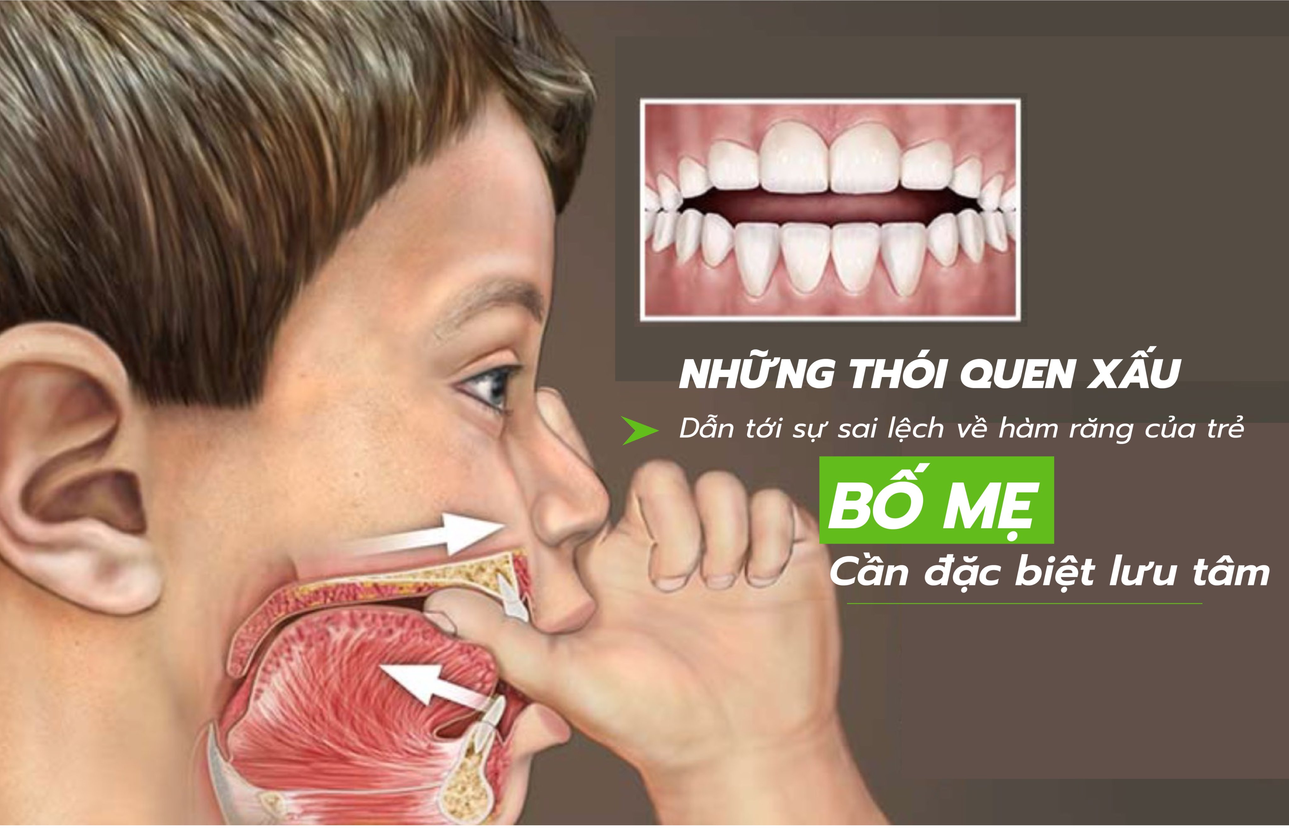 Những thói quen xấu dẫn đến sự sai lệch về hàm răng của trẻ, bố mẹ cần đặc biệt lưu tâm - Nha Khoa Thùy Anh Thái Nguyên